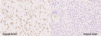 Neurocan Rabbit Polyclonal Antibody