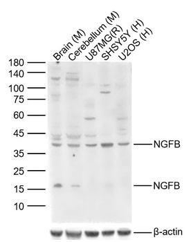 NGFB Rabbit Polyclonal Antibody