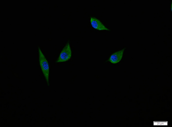 NGFB Rabbit Polyclonal Antibody