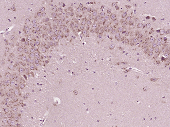 Sodium hydrogen exchanger 1 Rabbit Polyclonal Antibody