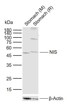 NIS Rabbit Polyclonal Antibody