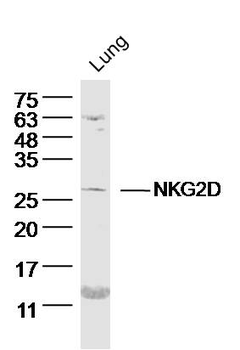 NKG2D Rabbit Polyclonal Antibody