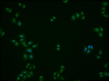 NME1/NM23A Rabbit Polyclonal Antibody