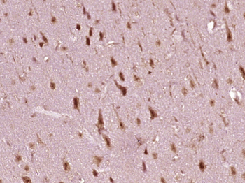 Nm23-H2/NME2 Rabbit Polyclonal Antibody