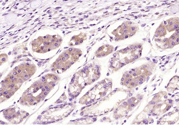 NPPC/Atrial natriuretic peptide Rabbit Polyclonal Antibody