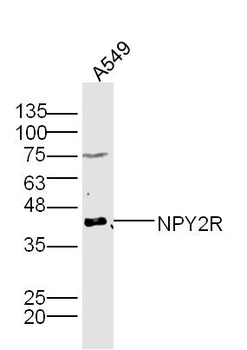 NPY2R Rabbit Polyclonal Antibody