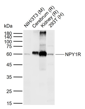 NPY1R Rabbit Polyclonal Antibody