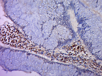 NRF1 Rabbit Polyclonal Antibody