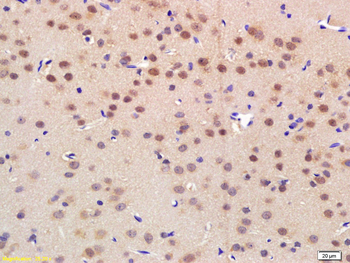 NRF1 Rabbit Polyclonal Antibody