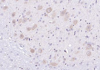Neurotrophin 3 Rabbit Polyclonal Antibody