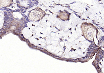 Neurotrophin 3 Rabbit Polyclonal Antibody