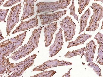 Geminin Rabbit Polyclonal Antibody