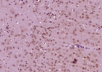 OCT-1 Rabbit Polyclonal Antibody