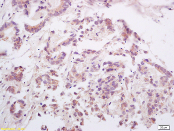 RANKL/CD254 Rabbit Polyclonal Antibody