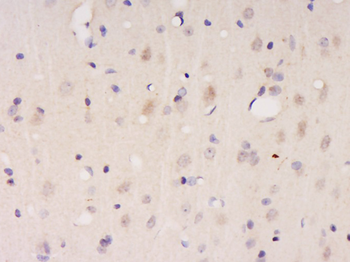 CDKN2A/p19ARF Rabbit Polyclonal Antibody