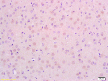 CDKN2A/p19ARF Rabbit Polyclonal Antibody