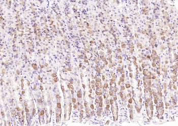 CDKN2A/p16-INK4a Rabbit Polyclonal Antibody