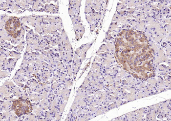 CDKN2A/p16-INK4a Rabbit Polyclonal Antibody