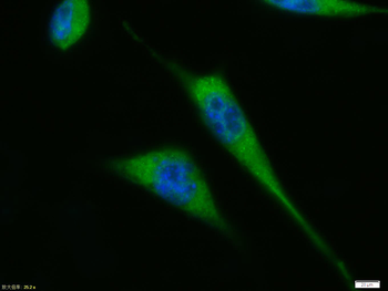 P53 protein (wt-p53) Rabbit Polyclonal Antibody