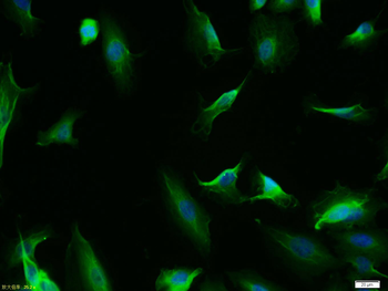 P53 protein (wt-p53) Rabbit Polyclonal Antibody