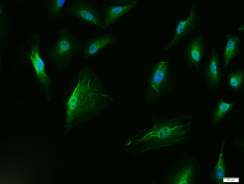P53 protein (wt-p53) Rabbit Polyclonal Antibody
