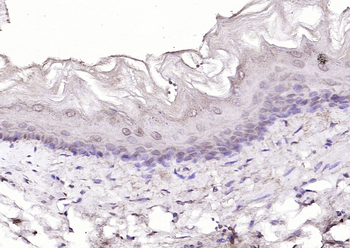 P53 protein (wt-p53) Rabbit Polyclonal Antibody