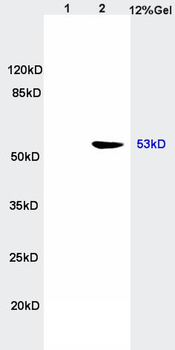 P53 protein (wt-p53) Rabbit Polyclonal Antibody