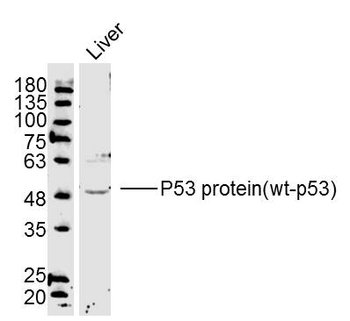 P53 protein (wt-p53) Rabbit Polyclonal Antibody