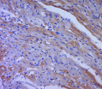 RPS6KB1 Rabbit Polyclonal Antibody