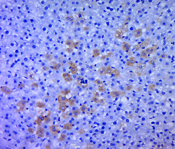 RPS6KB1 Rabbit Polyclonal Antibody