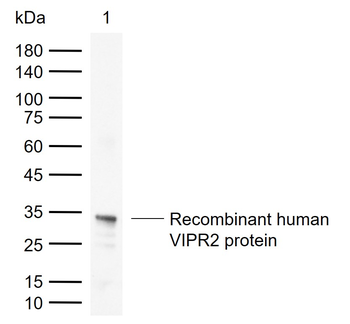 VIPR2 Rabbit Polyclonal Antibody