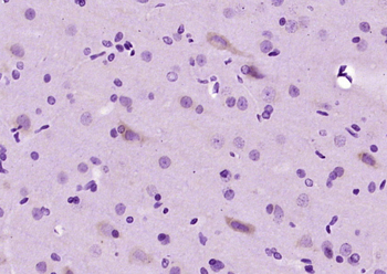 O-GlcNAc transferase Rabbit Polyclonal Antibody