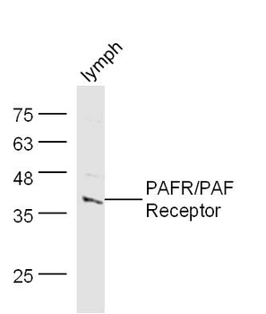 PAFR/PAF Receptor Rabbit Polyclonal Antibody