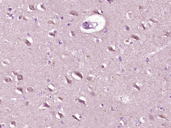 Phospho-PAK1/2/3 (Thr423) Rabbit Polyclonal Antibody