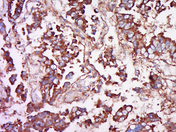 PAR1 Rabbit Polyclonal Antibody