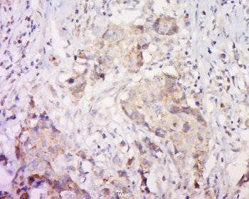 PAR-2 Rabbit Polyclonal Antibody