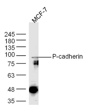P-cadherin Rabbit Polyclonal Antibody