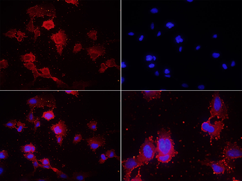 P-cadherin Rabbit Polyclonal Antibody