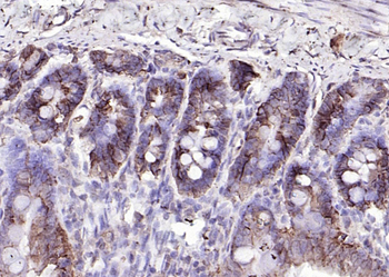 CDH17／LI Cadherin Rabbit Polyclonal Antibody