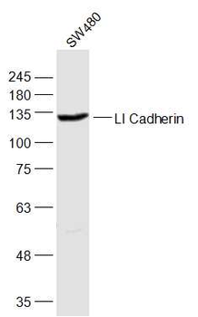 CDH17／LI Cadherin Rabbit Polyclonal Antibody
