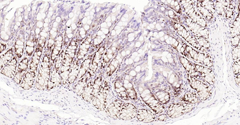PCNA Rabbit Polyclonal Antibody