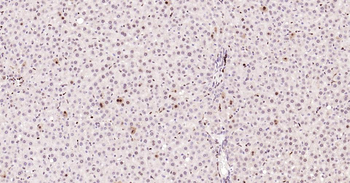 PCNA Rabbit Polyclonal Antibody