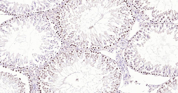 PCNA Rabbit Polyclonal Antibody