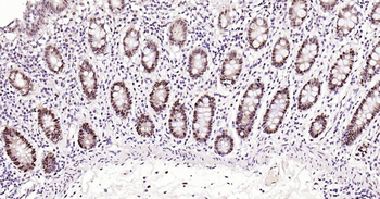 PCNA Rabbit Polyclonal Antibody