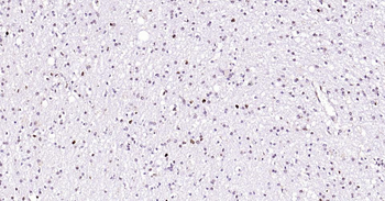 PCNA Rabbit Polyclonal Antibody