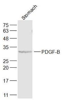 PDGF-B Rabbit Polyclonal Antibody