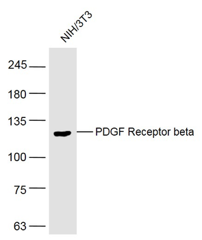PDGF Receptor beta Rabbit Polyclonal Antibody