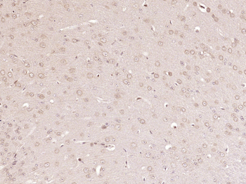 PIK3CA Rabbit Polyclonal Antibody