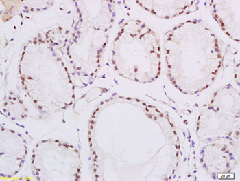 PPAR delta + beta Rabbit Polyclonal Antibody