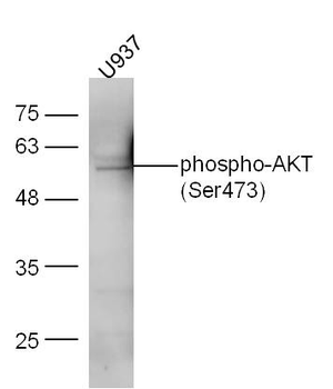 Phospho-AKT (Ser473) Rabbit Polyclonal Antibody